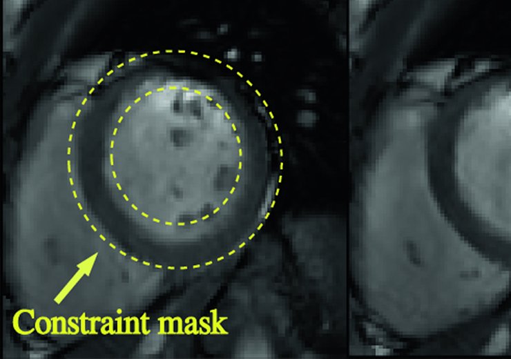 Incompressible Image Registration using Divergence-conforming B-Splines